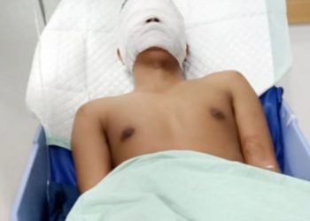 Wartawan di Siram Air Keras Oleh OTK