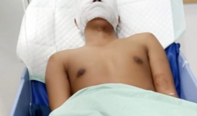 Wartawan di Siram Air Keras Oleh OTK