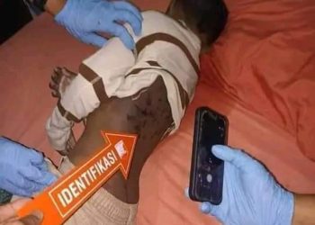 Miris, Bocah 9 Tahun di Gorontalo Tewas Dianiaya Paman dan Tantenya