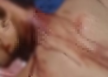 Warga Tanjung Nangko Nyaris Tewas Dibacok Geng Motor di Jambi Timur 