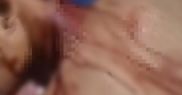 Warga Tanjung Nangko Nyaris Tewas Dibacok Geng Motor di Jambi Timur 