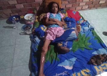 Ibu 3 Anak Penderita Tumor Ganas di Muaro Jambi Butuh Uluran Tangan Dermawan 