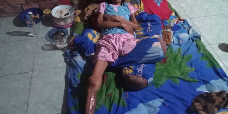 Ibu 3 Anak Penderita Tumor Ganas di Muaro Jambi Butuh Uluran Tangan Dermawan 