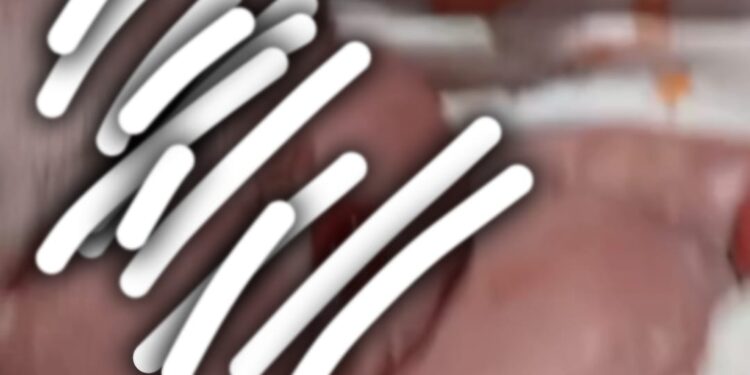 Diduga Salah Suntik, Bayi Dalam Kandungan Meninggal di RSIA Annisa Kota Jambi 